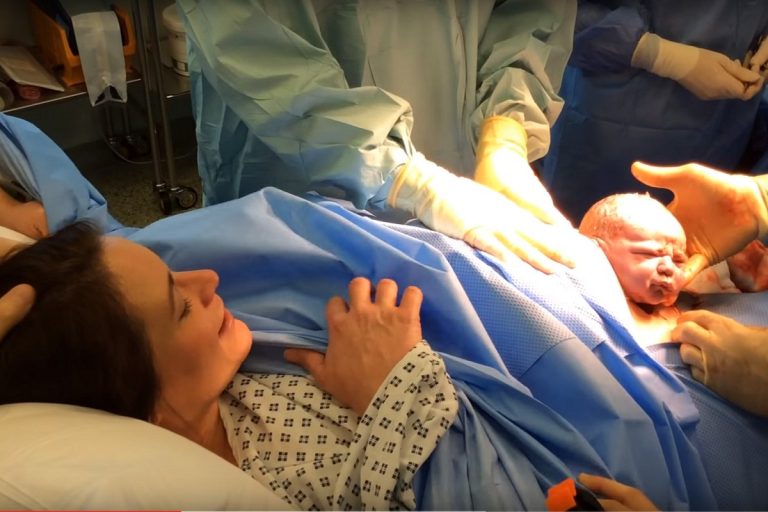 Natural Caesarean The New Trend In Birthing 