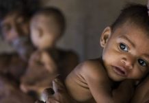 CHILD MALNUTRITION RATES IN MAHARASHTRA ARE ALARMING!